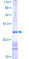 ab153263 on a 12.5% SDS-PAGE stained with Coomassie Blue.