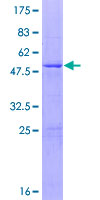 ab165087 on a 12.5% SDS-PAGE stained with Coomassie Blue.