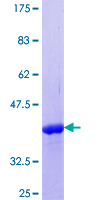 ab165088 on a 12.5% SDS-PAGE stained with Coomassie Blue.