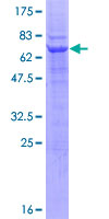 ab161864 on a 12.5% SDS-PAGE stained with Coomassie Blue.