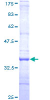 ab161865 on a 12.5% SDS-PAGE stained with Coomassie Blue.