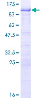 ab153613 on a 12.5% SDS-PAGE stained with Coomassie Blue.