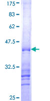 ab153614 on a 12.5% SDS-PAGE stained with Coomassie Blue.