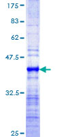 ab166030 on a 12.5% SDS-PAGE stained with Coomassie Blue.