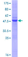 ab164360 on a 12.5% SDS-PAGE stained with Coomassie Blue.