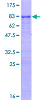 ab166211 on a 12.5% SDS-PAGE stained with Coomassie Blue.
