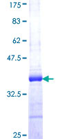 ab166212 on a 12.5% SDS-PAGE stained with Coomassie Blue.