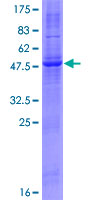 ab165975 on a 12.5% SDS-PAGE stained with Coomassie Blue.