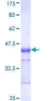ab165976 on a 12.5% SDS-PAGE stained with Coomassie Blue.