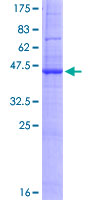 ab165417 on a 12.5% SDS-PAGE stained with Coomassie Blue.