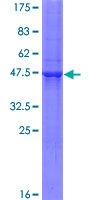 ab164857 on a 12.5% SDS-PAGE stained with Coomassie Blue.