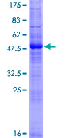 ab162777 on a 12.5% SDS-PAGE stained with Coomassie Blue.