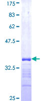 ab162778 on a 12.5% SDS-PAGE stained with Coomassie Blue.
