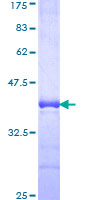 ab163369 on a 12.5% SDS-PAGE stained with Coomassie Blue.