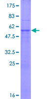 ab162704 on a 12.5% SDS-PAGE stained with Coomassie Blue.
