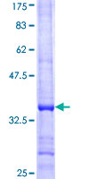 ab162705 on a 12.5% SDS-PAGE stained with Coomassie Blue.