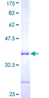 ab166555 on a 12.5% SDS-PAGE stained with Coomassie Blue.