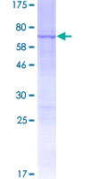 ab165860 on a 12.5% SDS-PAGE stained with Coomassie Blue.