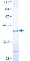 ab163387 on a 12.5% SDS-PAGE stained with Coomassie Blue.