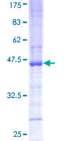 ab160953 on a 12.5% SDS-PAGE stained with Coomassie Blue.