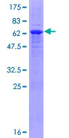 ab165470 on a 12.5% SDS-PAGE stained with Coomassie Blue.