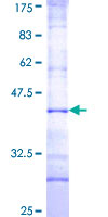 ab165471 on a 12.5% SDS-PAGE stained with Coomassie Blue.
