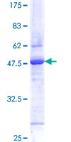 ab159362 on a 12.5% SDS-PAGE stained with Coomassie Blue.