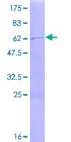 ab164777 on a 12.5% SDS-PAGE stained with Coomassie Blue.