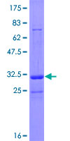 ab163112 on a 12.5% SDS-PAGE stained with Coomassie Blue.