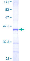 ab163113 on a 12.5% SDS-PAGE stained with Coomassie Blue.