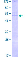ab163137 on a 12.5% SDS-PAGE stained with Coomassie Blue.