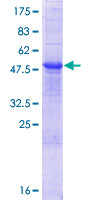 ab166257 on a 12.5% SDS-PAGE stained with Coomassie Blue.