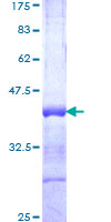 ab159364 on a 12.5% SDS-PAGE stained with Coomassie Blue.