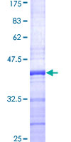 ab160505 on a 12.5% SDS-PAGE stained with Coomassie Blue.