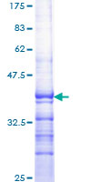 ab159367 on a 12.5% SDS-PAGE stained with Coomassie Blue.