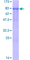 ab159369 on a 12.5% SDS-PAGE stained with Coomassie Blue.