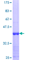 ab159370 on a 12.5% SDS-PAGE stained with Coomassie Blue.