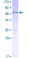 ab159371 on a 12.5% SDS-PAGE stained with Coomassie Blue.
