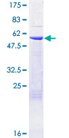 ab162273 on a 12.5% SDS-PAGE stained with Coomassie Blue.