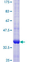ab162274 on a 12.5% SDS-PAGE stained with Coomassie Blue.