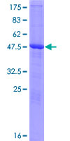 ab164546 on a 12.5% SDS-PAGE stained with Coomassie Blue.