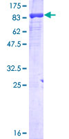 ab161078 on a 12.5% SDS-PAGE stained with Coomassie Blue.