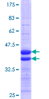 ab161079 on a 12.5% SDS-PAGE stained with Coomassie Blue.