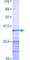ab159373 on a 12.5% SDS-PAGE stained with Coomassie Blue.