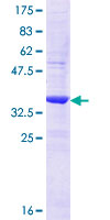 ab163477 on a 12.5% SDS-PAGE stained with Coomassie Blue.