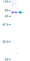 ab161193 on a 12.5% SDS-PAGE stained with Coomassie Blue.
