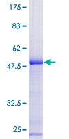 ab159378 on a 12.5% SDS-PAGE stained with Coomassie Blue.