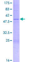 ab159379 on a 12.5% SDS-PAGE stained with Coomassie Blue.