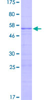 ab159383 on a 12.5% SDS-PAGE stained with Coomassie Blue.