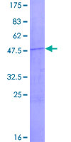 ab161670 on a 12.5% SDS-PAGE stained with Coomassie Blue.